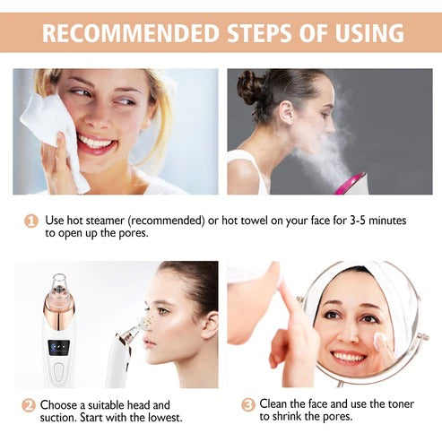 Electric Blackhead Remover - NextMamas
