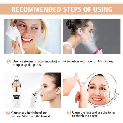 Electric Blackhead Remover - NextMamas