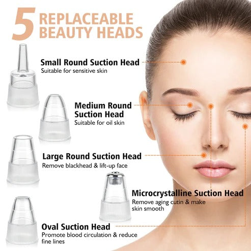 Electric Blackhead Remover - NextMamas