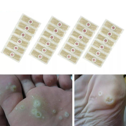 Foot Corn Pads – Remove Corns Quickly, Cushion Against Pressure - NextMamas